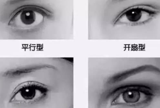 开眼角手术多久恢复，影响上班吗！