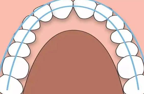 上海卡瓦齿科医生哪位技术好？高杰医生实操牙齿矫正案例图
