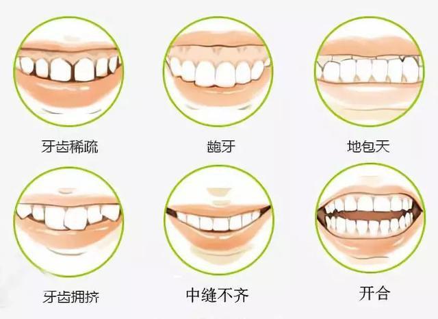 北京成爱金冠口腔门诊怎么样？内附院内牙齿矫正案例！
