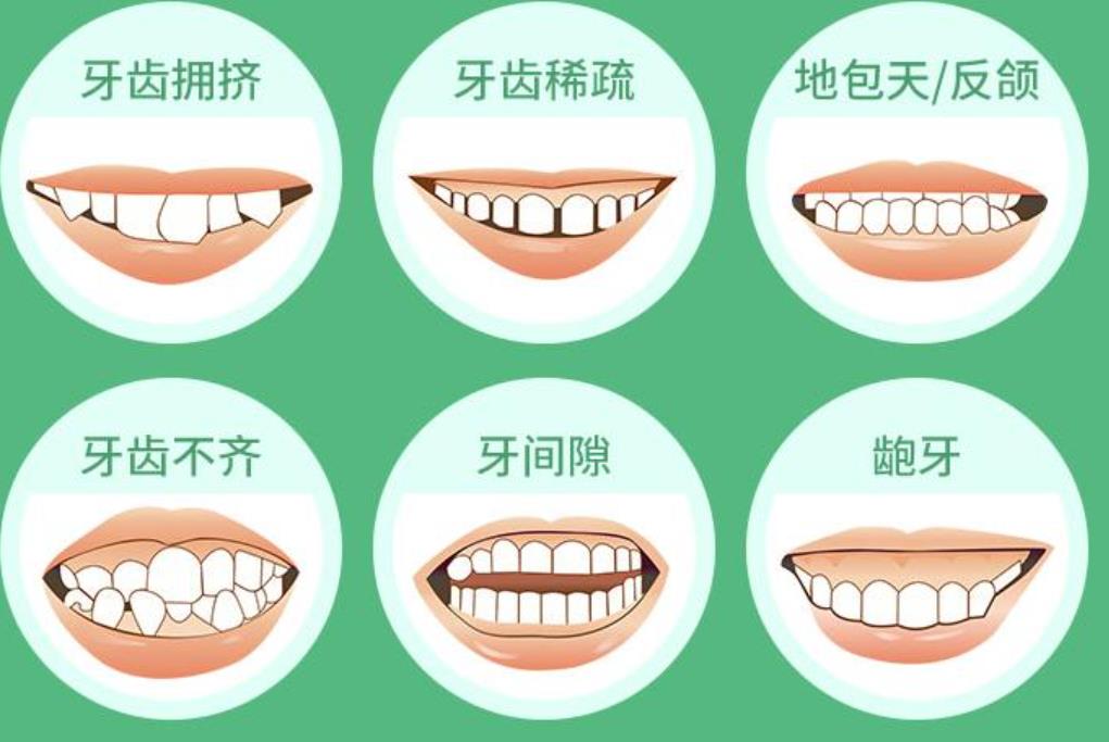 上海伟德口腔门诊部正畸怎么样？真人做牙齿矫正对比图曝光