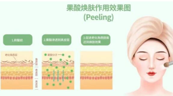 果酸换肤后注意事项，都需要了解！