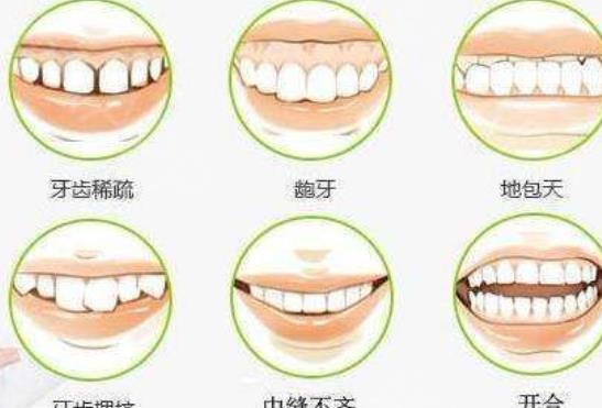 上海艺齿口腔牙齿矫正价格多少?真人做牙齿矫正过程图介绍!