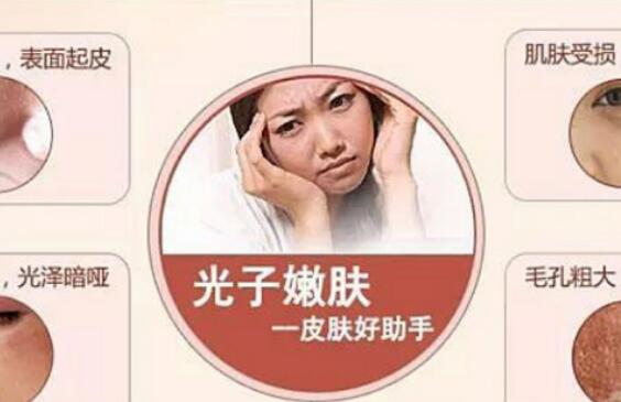 光子嫩肤去红血丝好吗，小技巧帮你有效缓解！