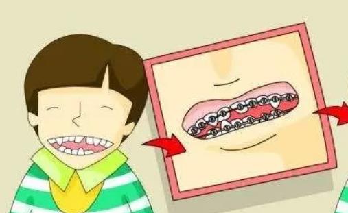 上海中博口腔医院贵吗?医院的技术优势是什么?案例参考