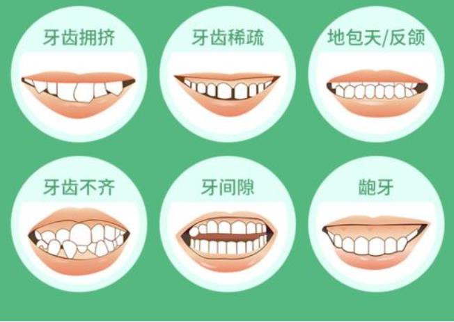 雅嘉口腔门诊部费用多少?贾海峰医生资料介绍!牙齿矫正方法推荐