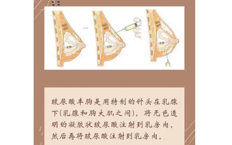 顾斌医生的技术怎么样？上海九院专家个人简介一览