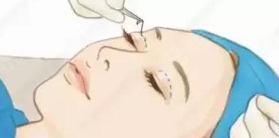 上海至仁医疗美容医院地址|真人做斑点去除案例图曝光！