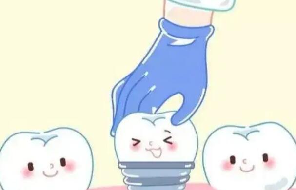 上海一番口腔怎么样？网友种牙亲身经历分享：效果真心不错！