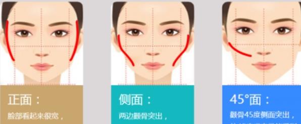 杨君毅磨骨多少钱一个部位？磨骨手术疼不疼？来看真人术后感受吧