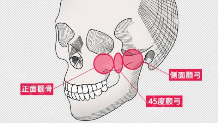 何晋龙医生口碑好不好？擅长的领域是什么？颧骨手术效果图曝光