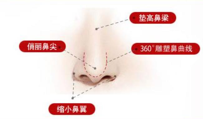 广州者梵医疗美容医院吴金倍医生技术好吗？实操鼻综合案例图曝光