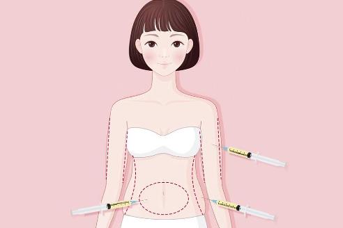 蒙自吴氏嘉美医院是正规医院吗？口碑好不好？吸脂案例介绍