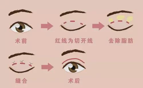 成都恩喜医疗美容做的怎么样?门诊部简介_医生信息_价格表