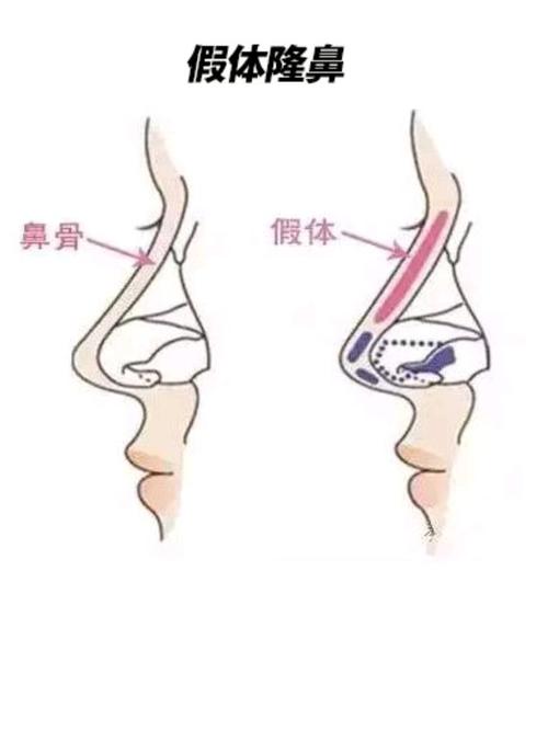 成都恩喜医疗美容做的怎么样?门诊部简介_医生信息_价格表