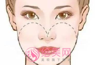 上海韩镜郑志雄磨骨擅长什么？医生技术优势是什么？价格表