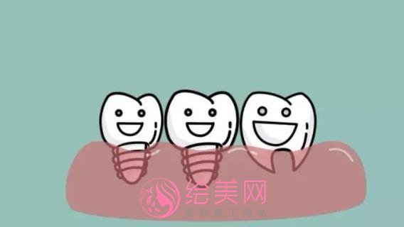 上海英博口腔种植怎么样？夏伟医生基本资料介绍！附收费表