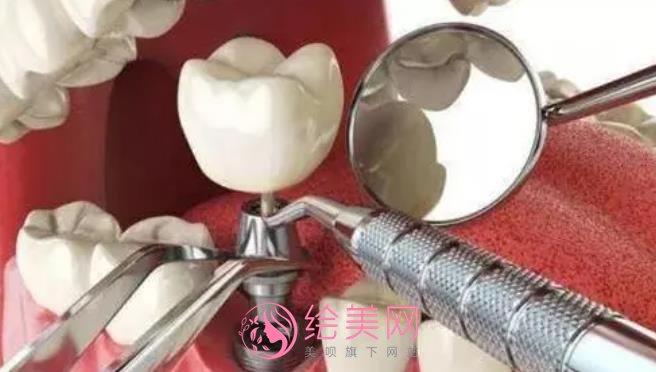 上海英博口腔种植怎么样？夏伟医生基本资料介绍！附收费表
