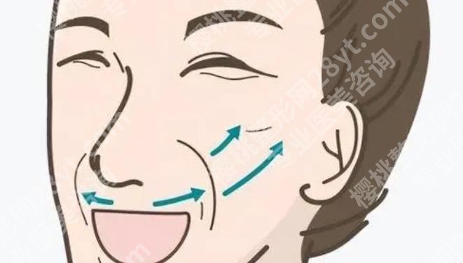 上海韩镜医疗美容医院除皱价格|附真人除皱全过程记录贴