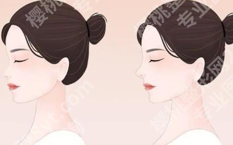上海珂莱娅医疗美容门诊部隆鼻价格多少?开展隆鼻项目介绍