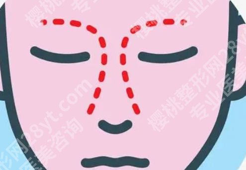 上海珂莱娅医疗美容门诊部隆鼻价格多少?开展隆鼻项目介绍
