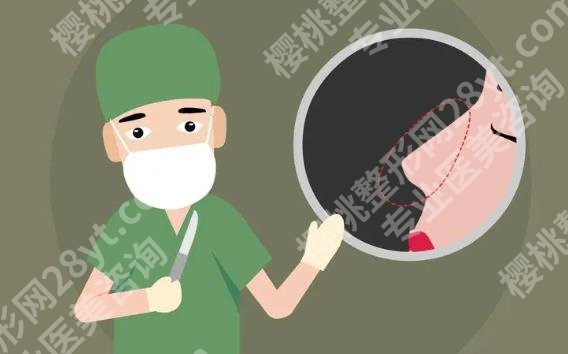 上海珂莱娅医疗美容门诊部隆鼻价格多少?开展隆鼻项目介绍