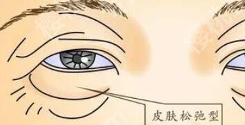 上海宏明医疗美容门诊部去眼袋价格大约是多少？医院概况及全新收费表更新！