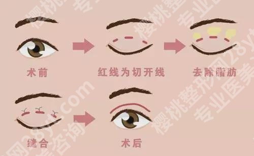 上海时光整形外科医院擅长项目介绍