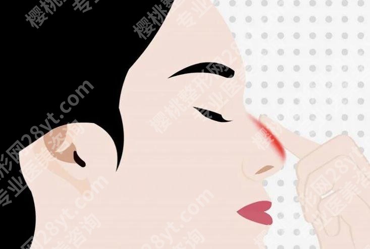 上海韩镜医疗美容医院鼻部整形多少钱？价格影响因素有哪些？