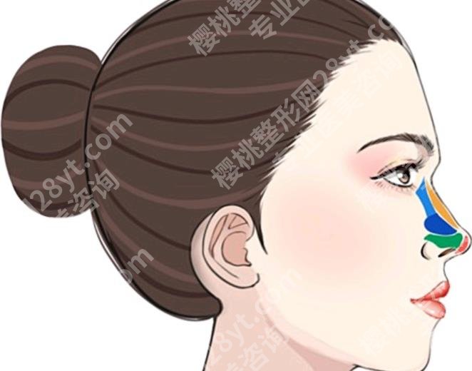 上海珂莱娅医疗美容门诊部隆鼻怎么样？沈国雄医生技术特色分析！