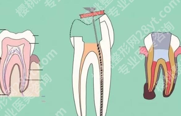 上海雅适美口腔医院根管调节技术靠谱吗？医院简介|网友亲身经历分享！