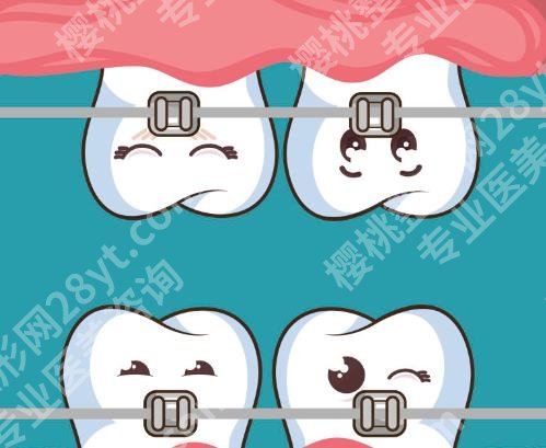 上海石四箴口腔医疗怎么样？石四箴医生技术特色介绍！案例图