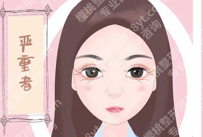 上海禾新医院医疗美容科价格贵吗？除皱效果自然吗？附真人案例哦！