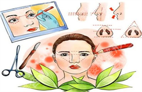 薇琳杨荣华个人简介!实力专家医生，假体隆鼻案例