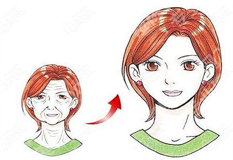 上海艺星医疗美容医院超声炮怎么样？案例整理了，附价目表参考