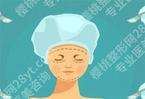 上海艺星面部提升怎么样？案例来袭，看前后变化图