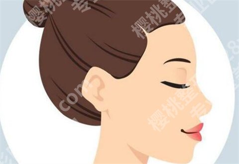 上海艺星面部提升怎么样？案例来袭，看前后变化图