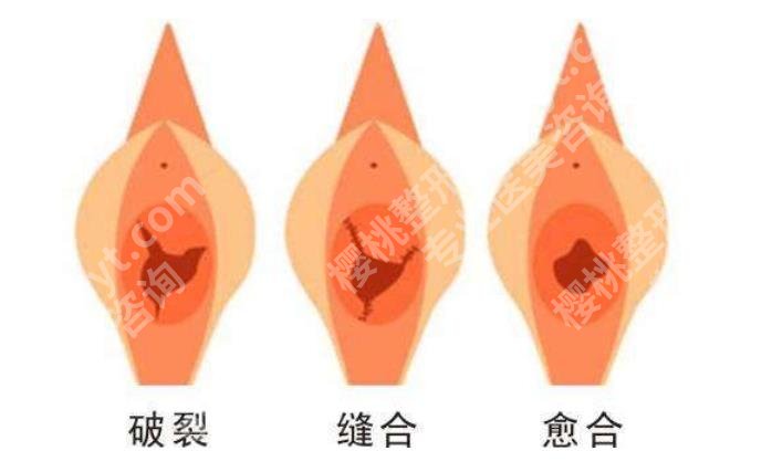 上海柏荟医疗美容门诊部做私密手术好吗？技术特色、价格表一览！