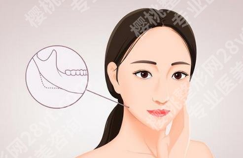 上海时光何晋龙去下颌角咬肌吗？案例风格点评，收费价格