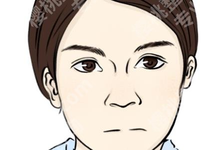 邱文苑做鼻子怎么样？坐诊医院是哪家？隆鼻案例曝光