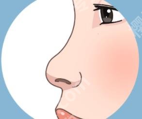 邱文苑做鼻子怎么样？坐诊医院是哪家？隆鼻案例曝光