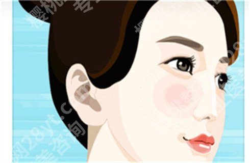 上海馥兰朵医疗美容门诊部隆鼻价格贵吗？医生有谁?案例详情