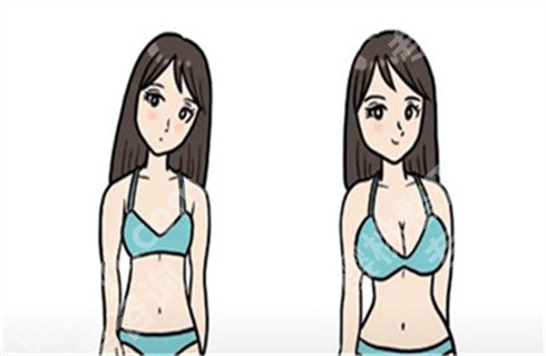 上海艺星医疗美容医院隆胸价格贵吗?医生介绍、案例介绍