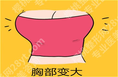 上海艺星医疗美容医院隆胸价格贵吗?医生介绍、案例介绍