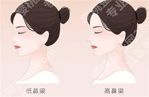 上海艺星医疗美容医院隆鼻价格高不高?人气医生介绍,隆鼻反馈