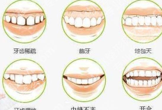 上海智星口腔门诊部正畸多少钱?医院特色项目及地址介绍