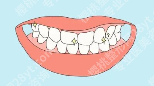 上海卓信口腔门诊部正畸怎么样？真人案例及收费情况介绍