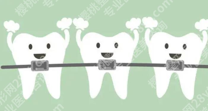 上海贤佳口腔门诊部正畸价格多少？齐海洋医生概况介绍！案例参考