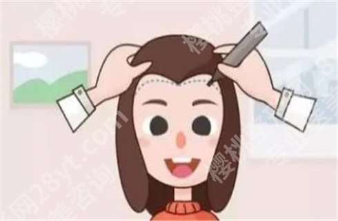 张久赋二次补发怎么样？医生实力介绍，一键提前预览！