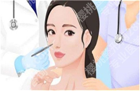 上海艺星王冬梅打玻尿酸好嘛？附相关案例，细节曝光！