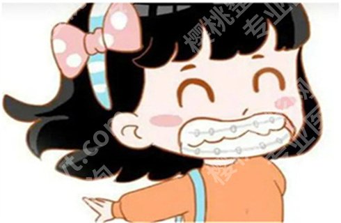 上海何晋龙医生去咬肌吗？医生介绍，实力不错，速围观！